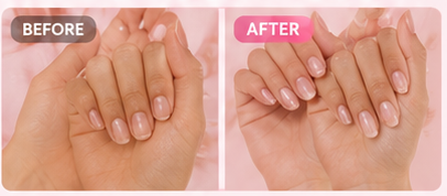 Nails recovering after years of gel